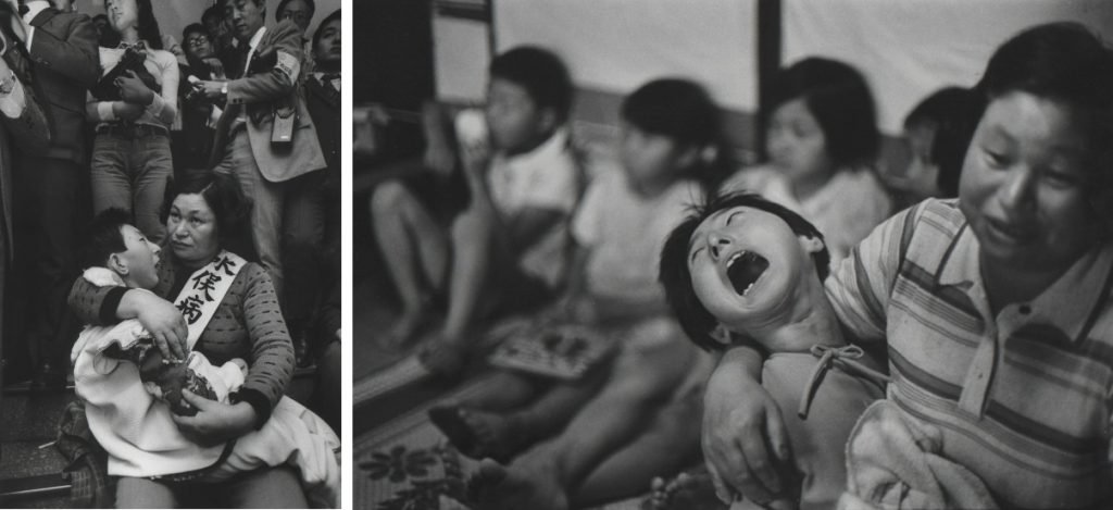 56b. “Minamata” – William Eugene Smith Reportage 14 10. bambini di minimata nati con malformazioni congenite.Foto W.E.Smith