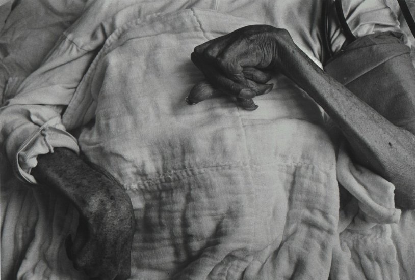 56b. “Minamata” – William Eugene Smith Reportage 15 15.la sindrome di minamata.Foto W.E.Smith
