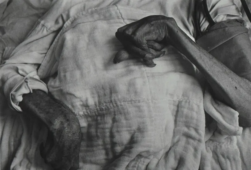15.la sindrome di minamata.Foto W.E.Smith