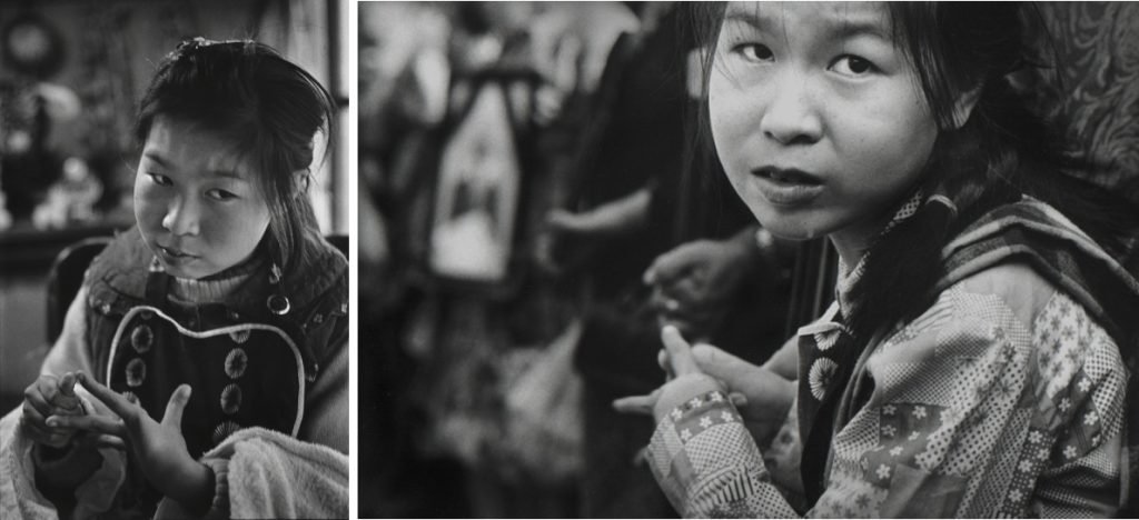 56b. “Minamata” – William Eugene Smith Reportage 25 23.Tanaka Jitsuko 18 anni fotografata da W.E.Smith nel 1971