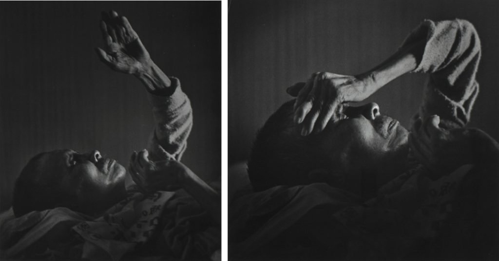 56b. “Minamata” – William Eugene Smith Reportage 33 30. Un uomo con la malattia di Minamata fotografato da William Eugene Smith 1971