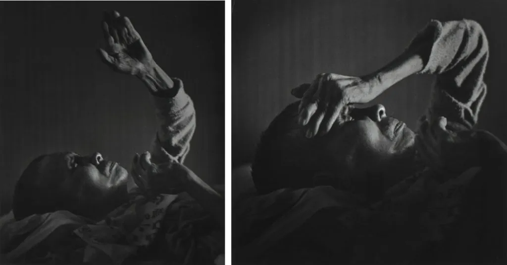 30. Un uomo con la malattia di Minamata fotografato da William Eugene Smith 1971